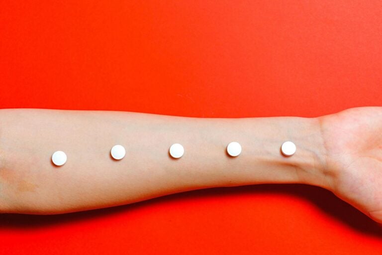 Five white dots arranged in a line on a person's forearm against red background