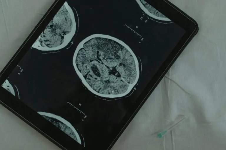 Brain CT scan displayed on digital tablet with medical needle beside it for examination