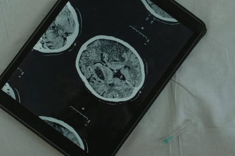 Brain CT scan displayed on digital tablet with medical needle beside it for examination