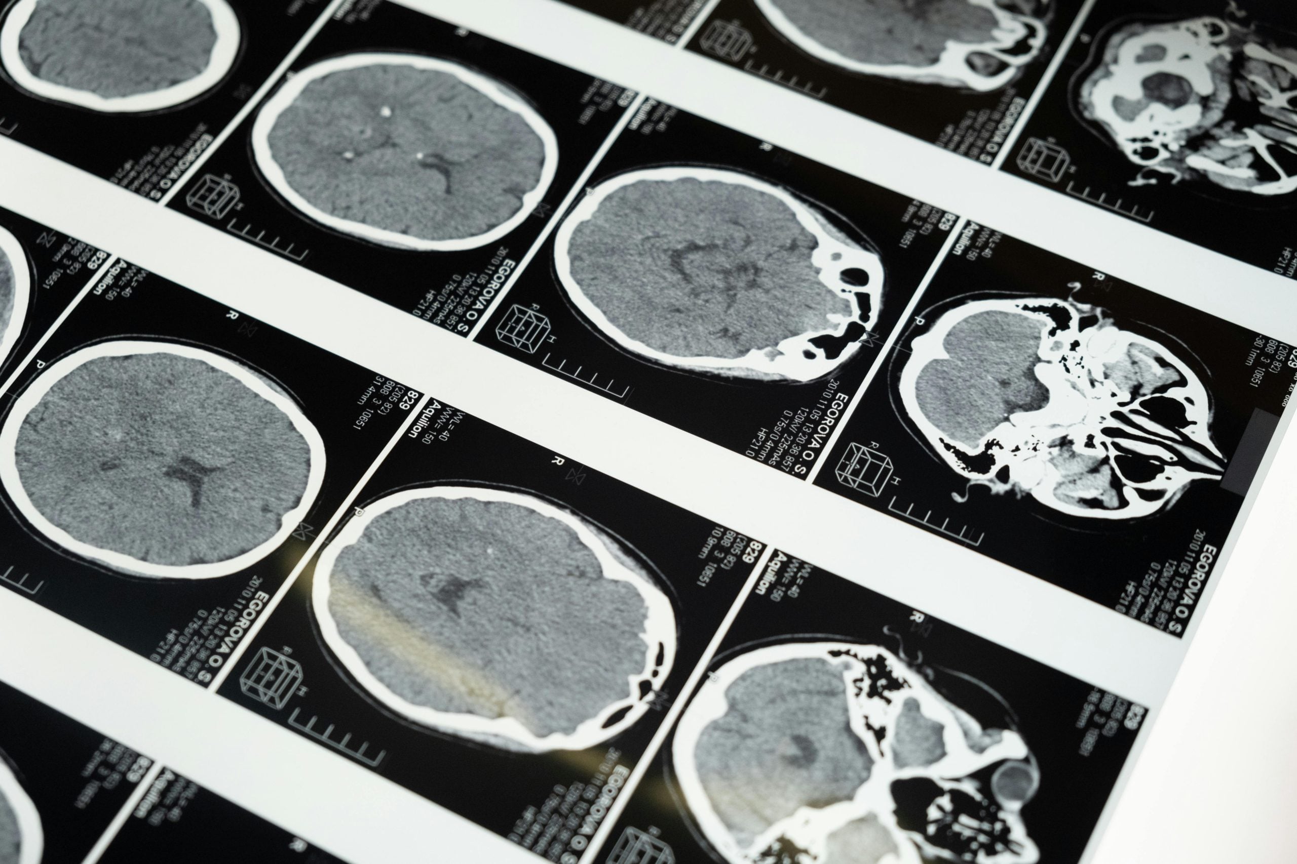 Image showing several brain scans in scientific display
