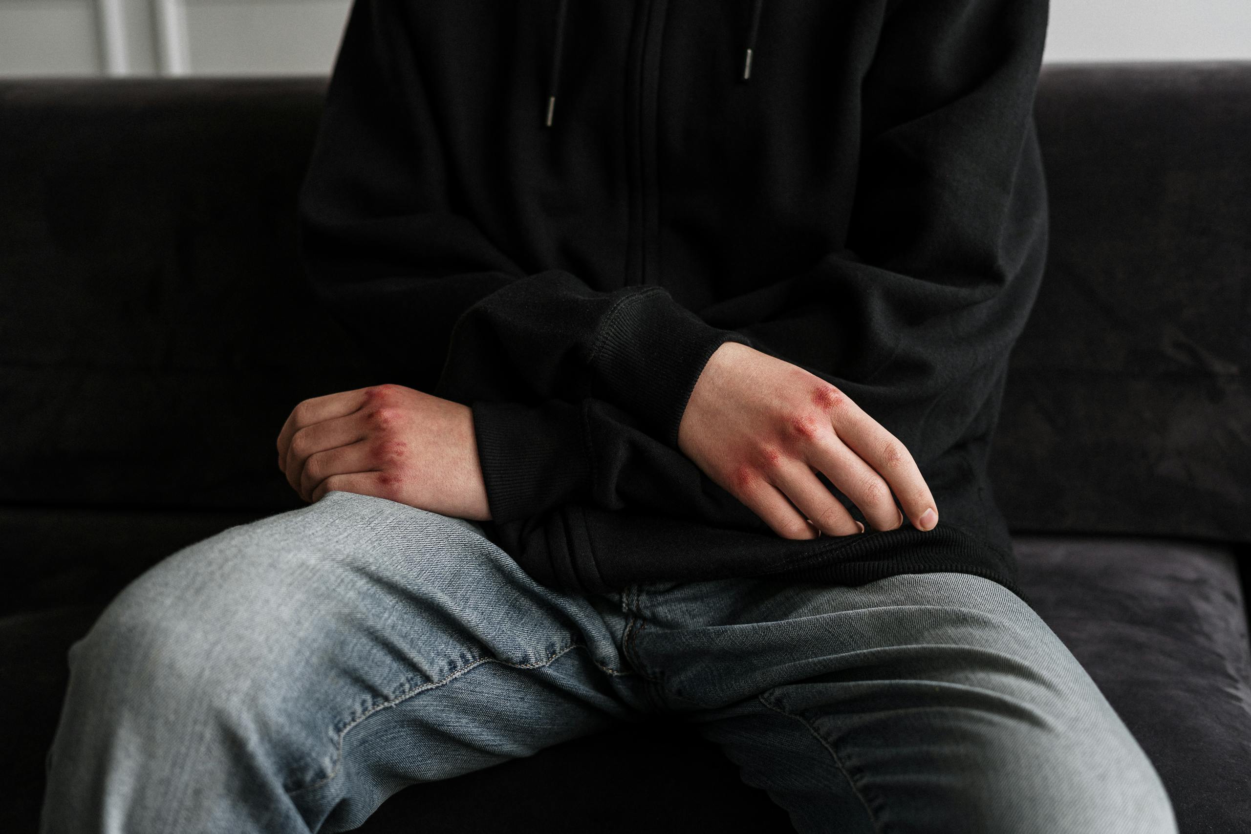Teenage boy with bruised hands wearing hoodie sitting alone on couch.
